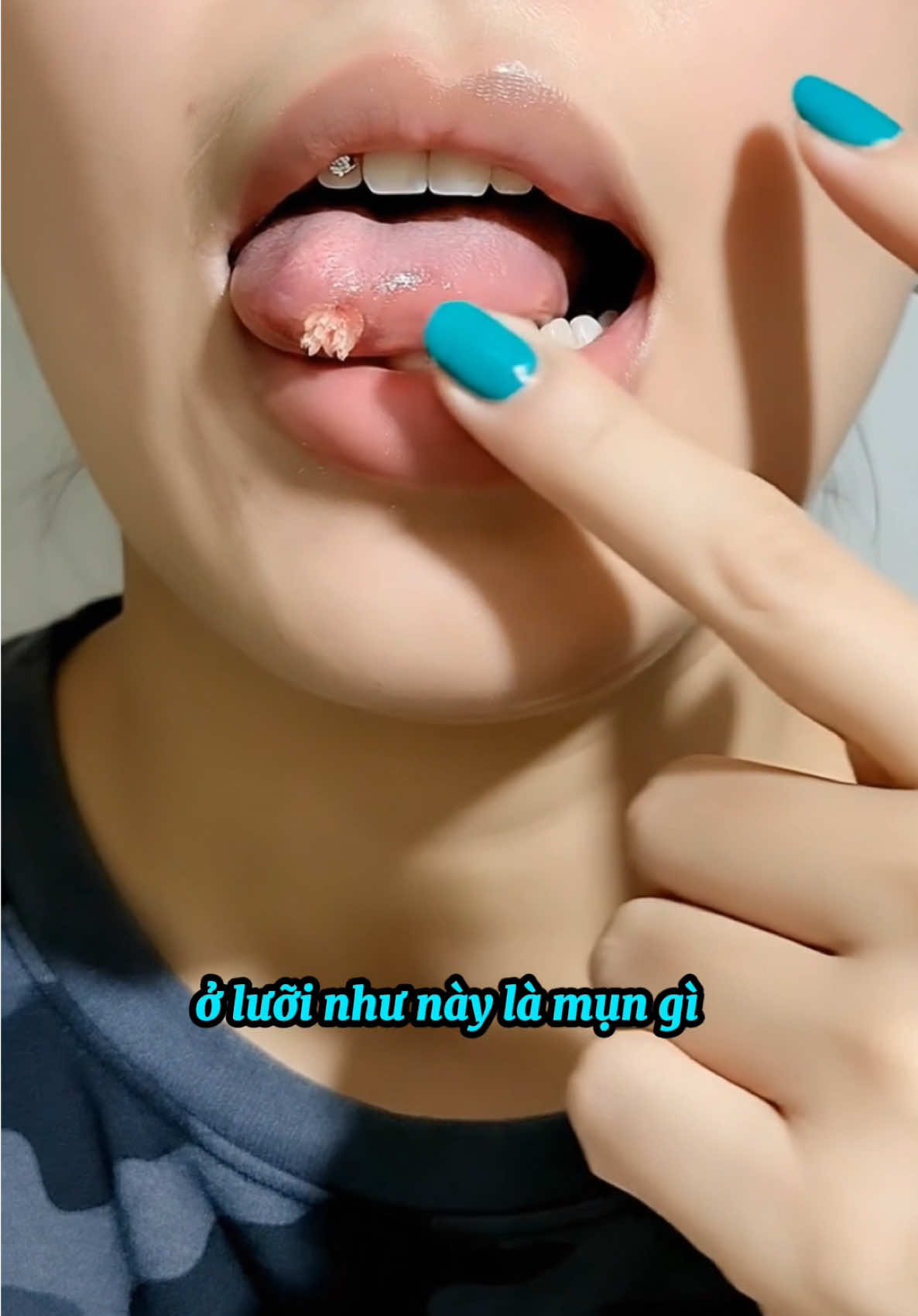 @Ds Thuỳ Dương