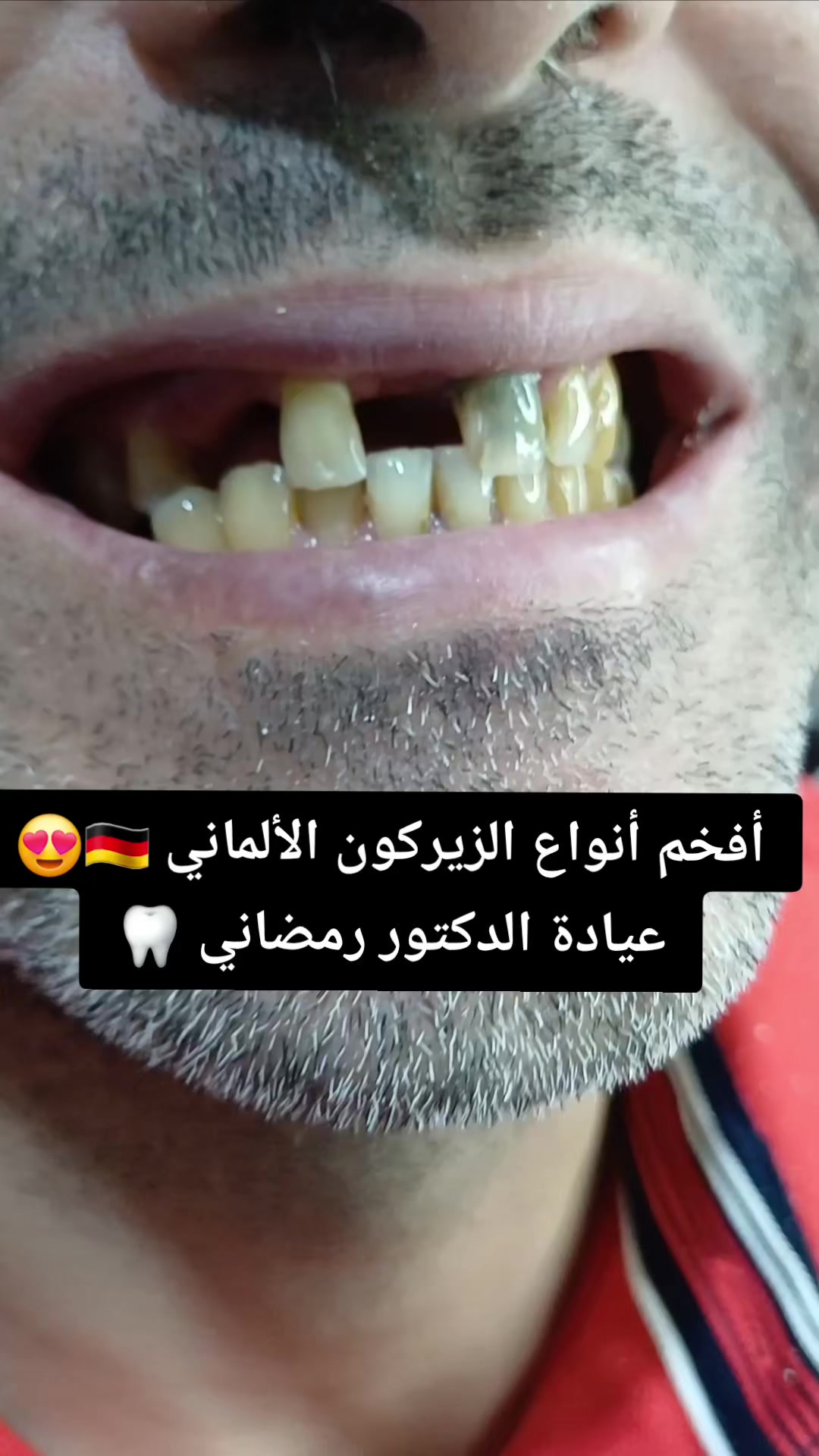 @Dr Ramdani Rassim
