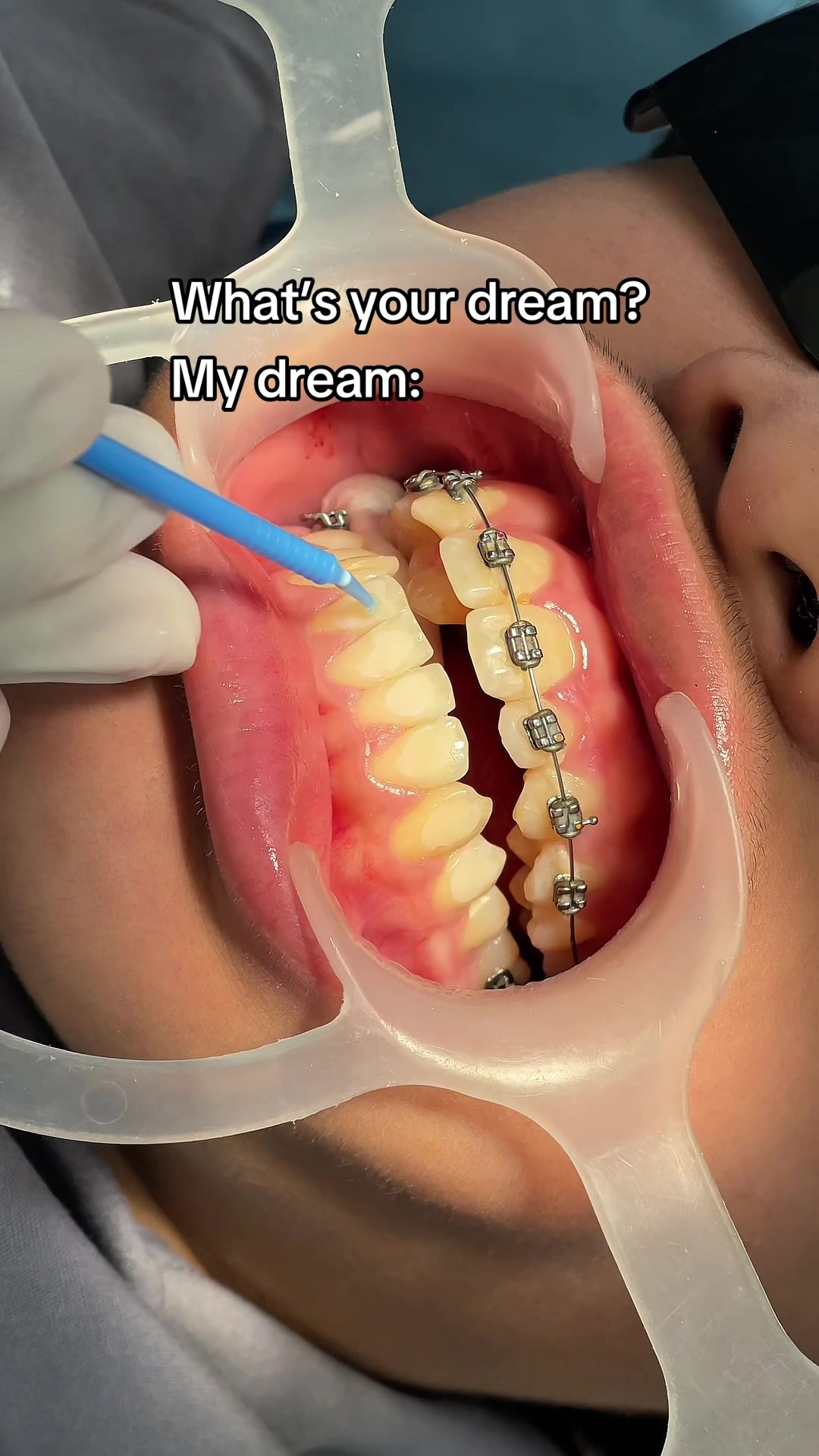 @BRIGHT SMILE DENTAL HOSPITAL