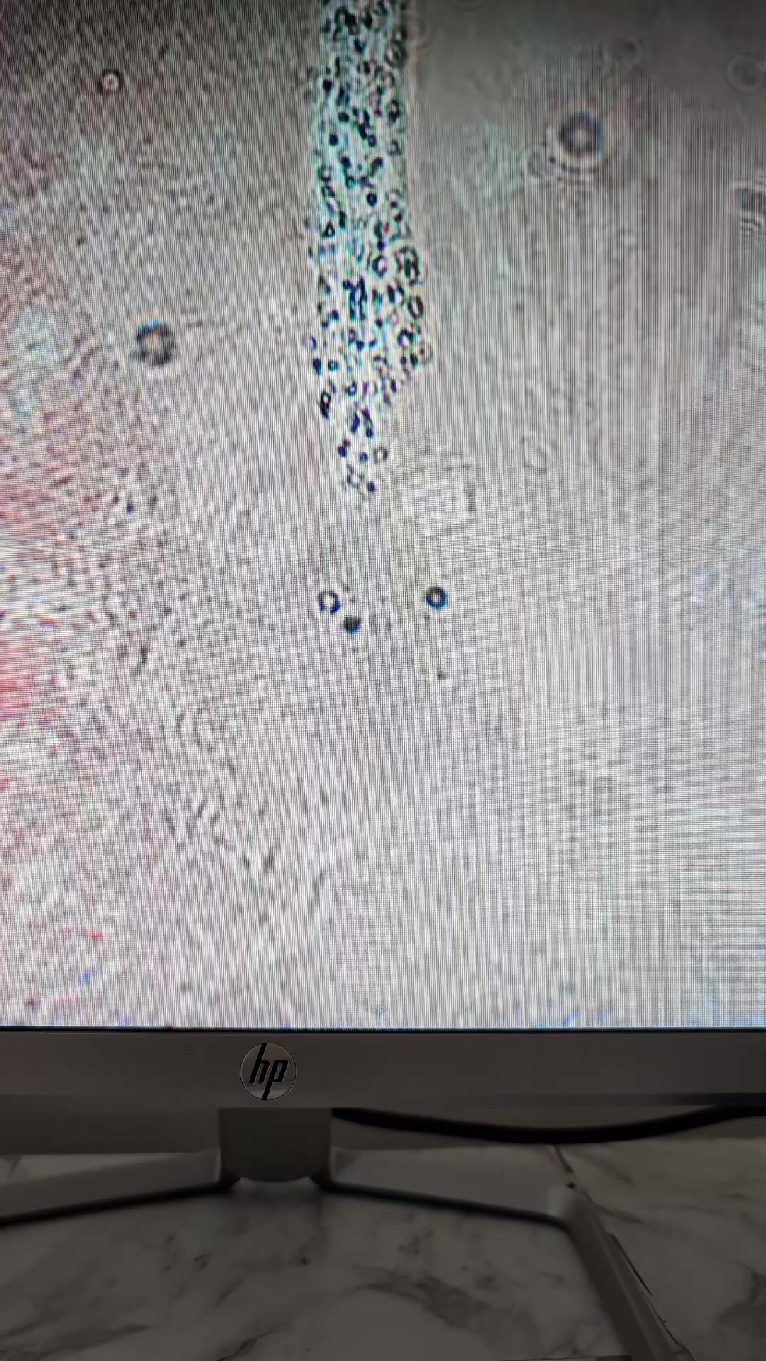 @HaemaFlow LiveBloodAnalysis