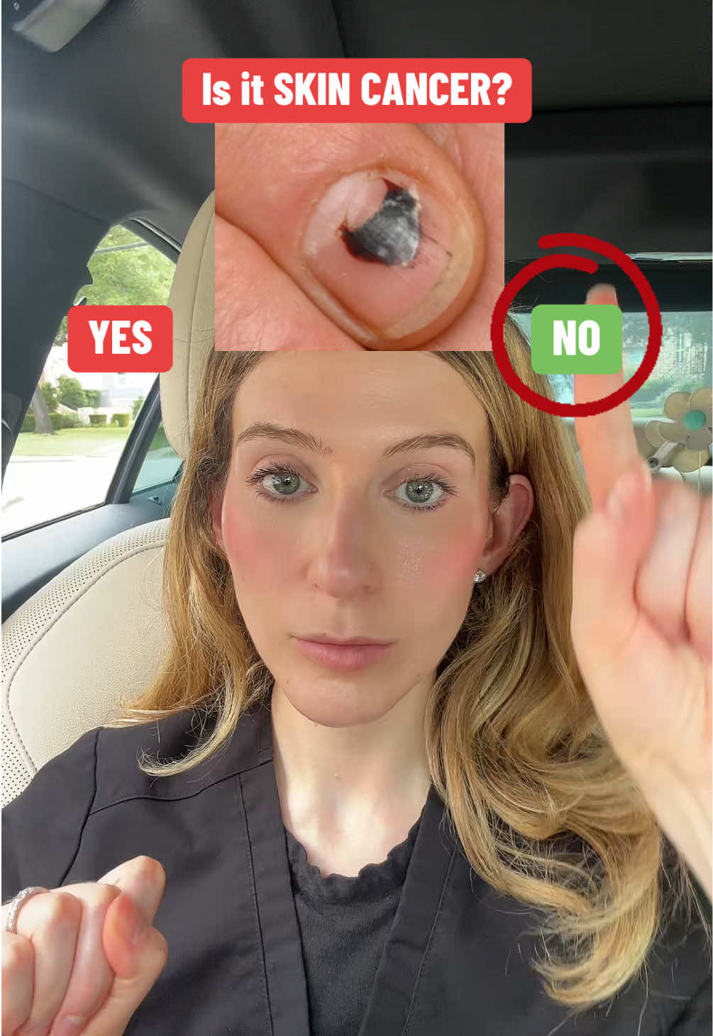 @Heather Kornmehl, MD