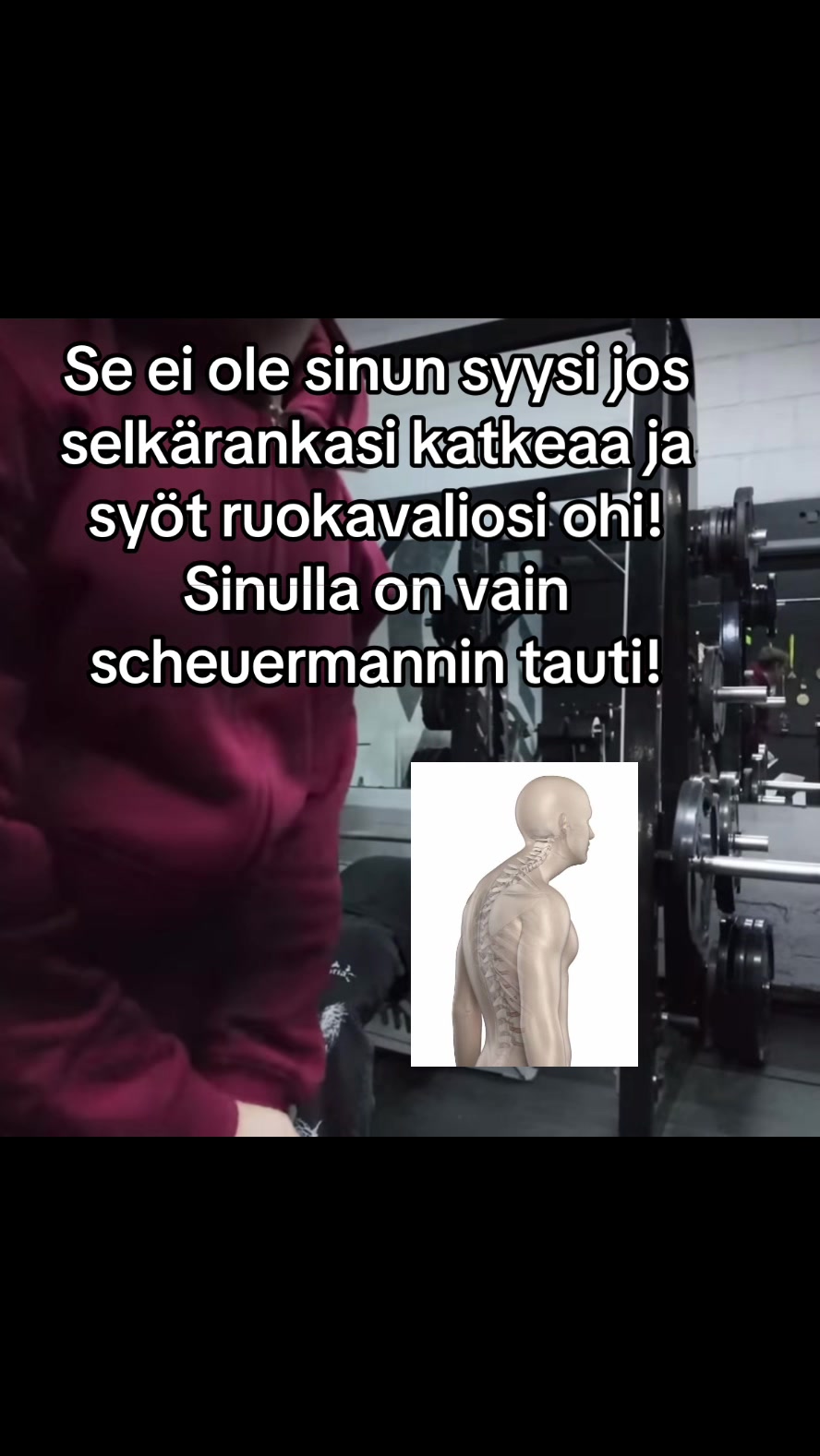 @gynovauva