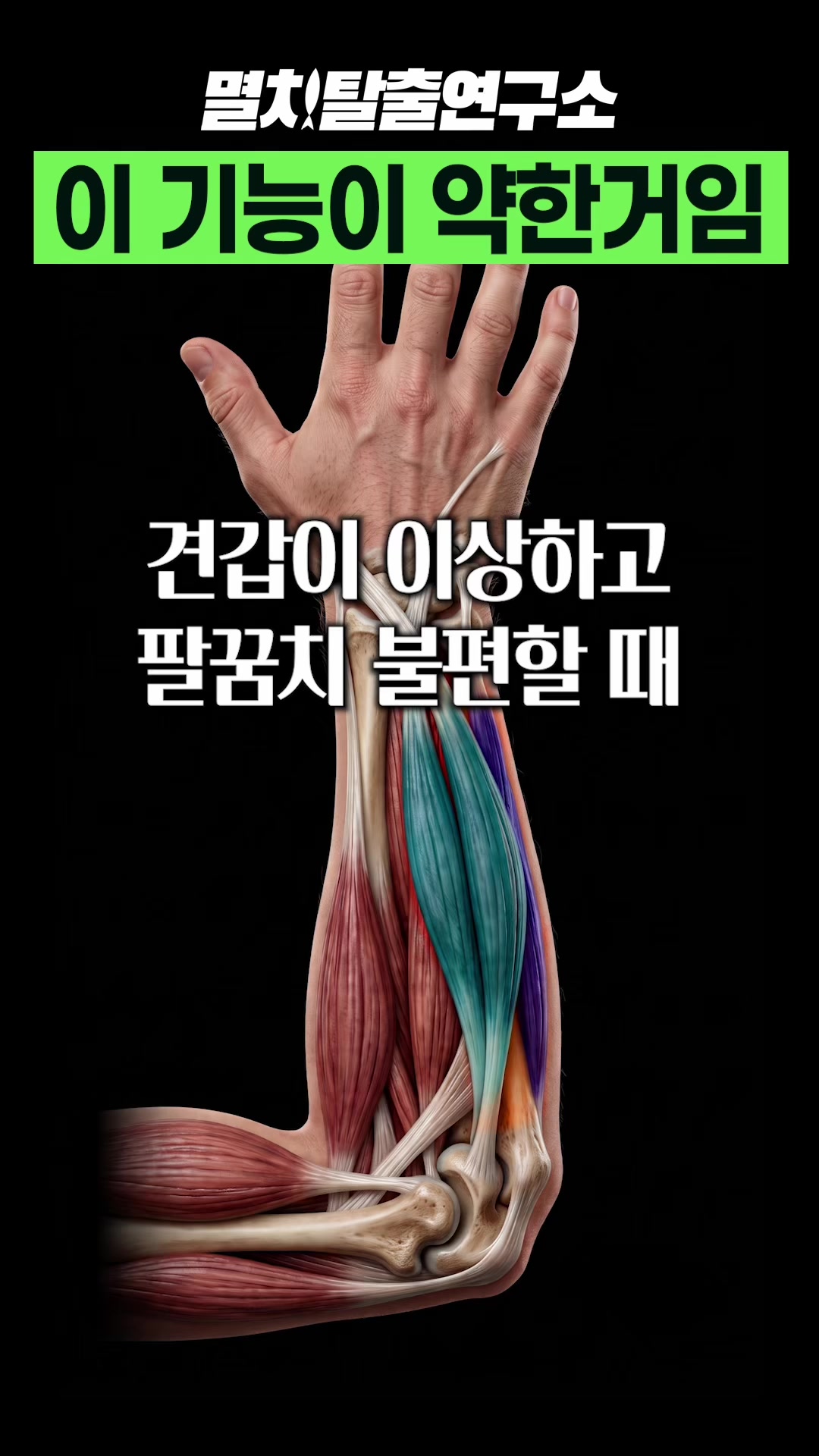 @멸치탈출연구소