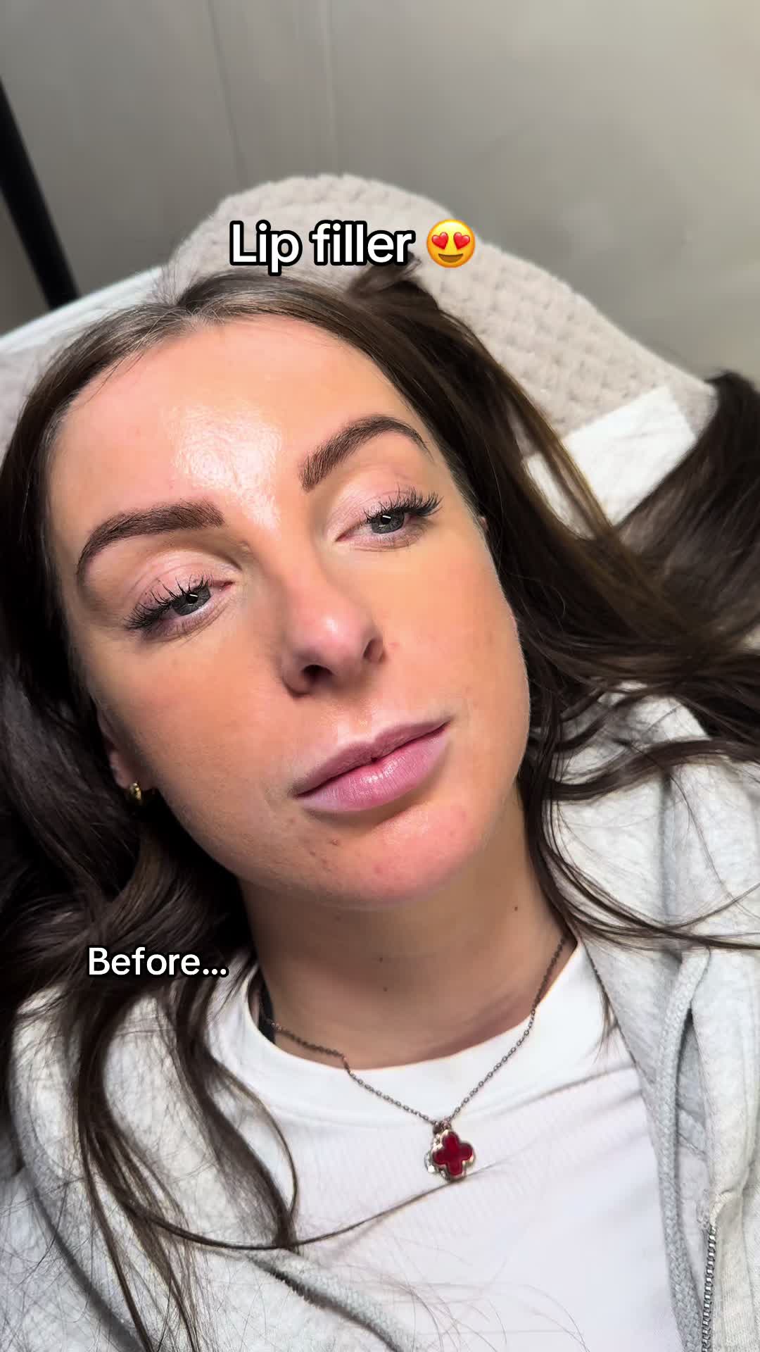 @face_ncl