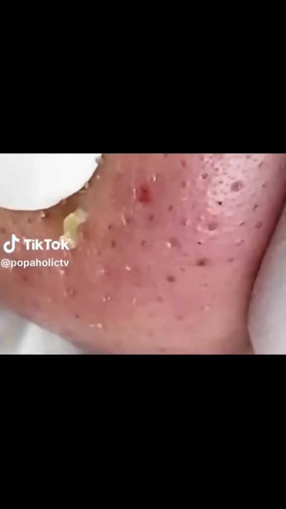 @Antonella Tarozzo