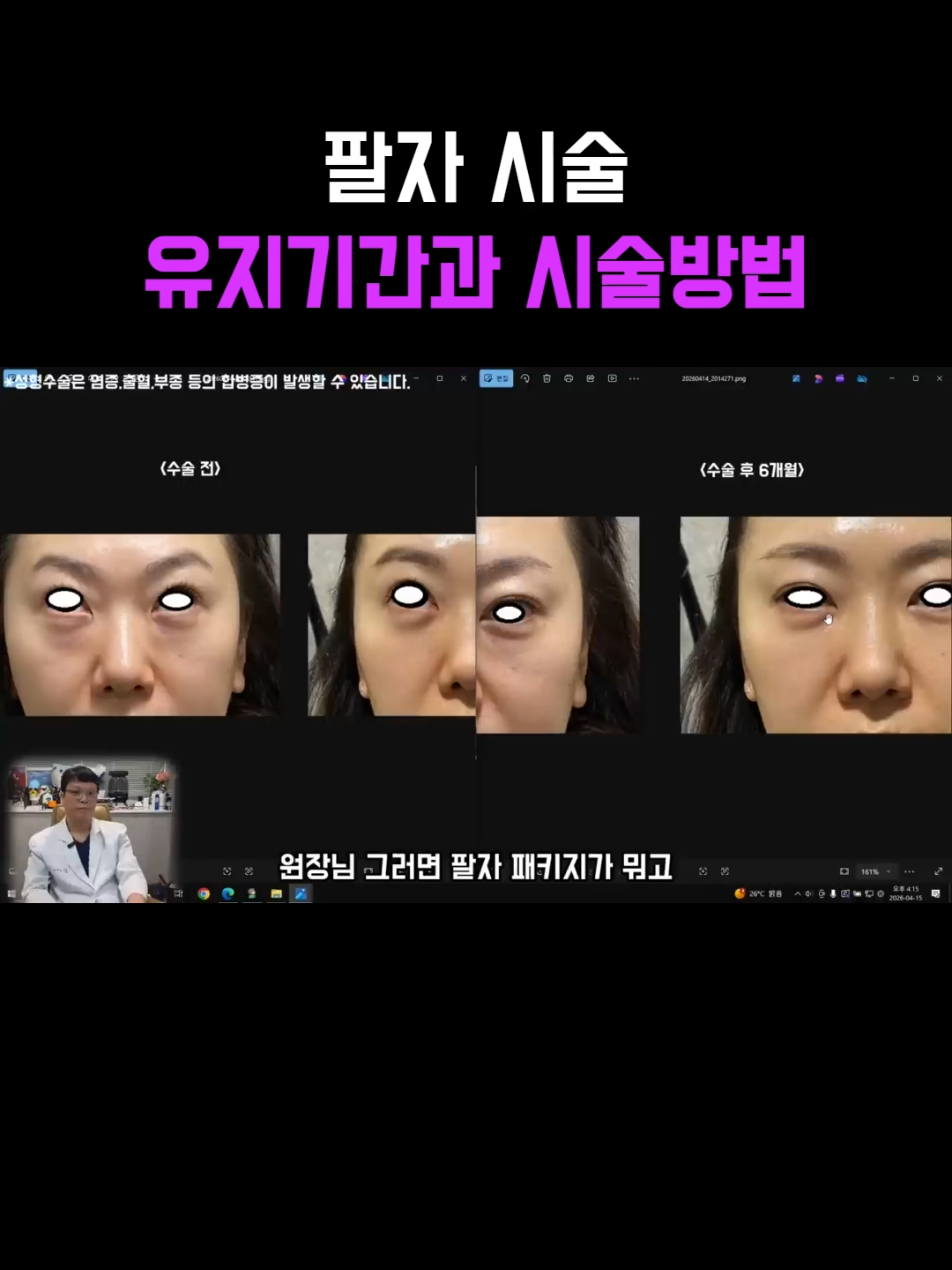 @미오름성형외과