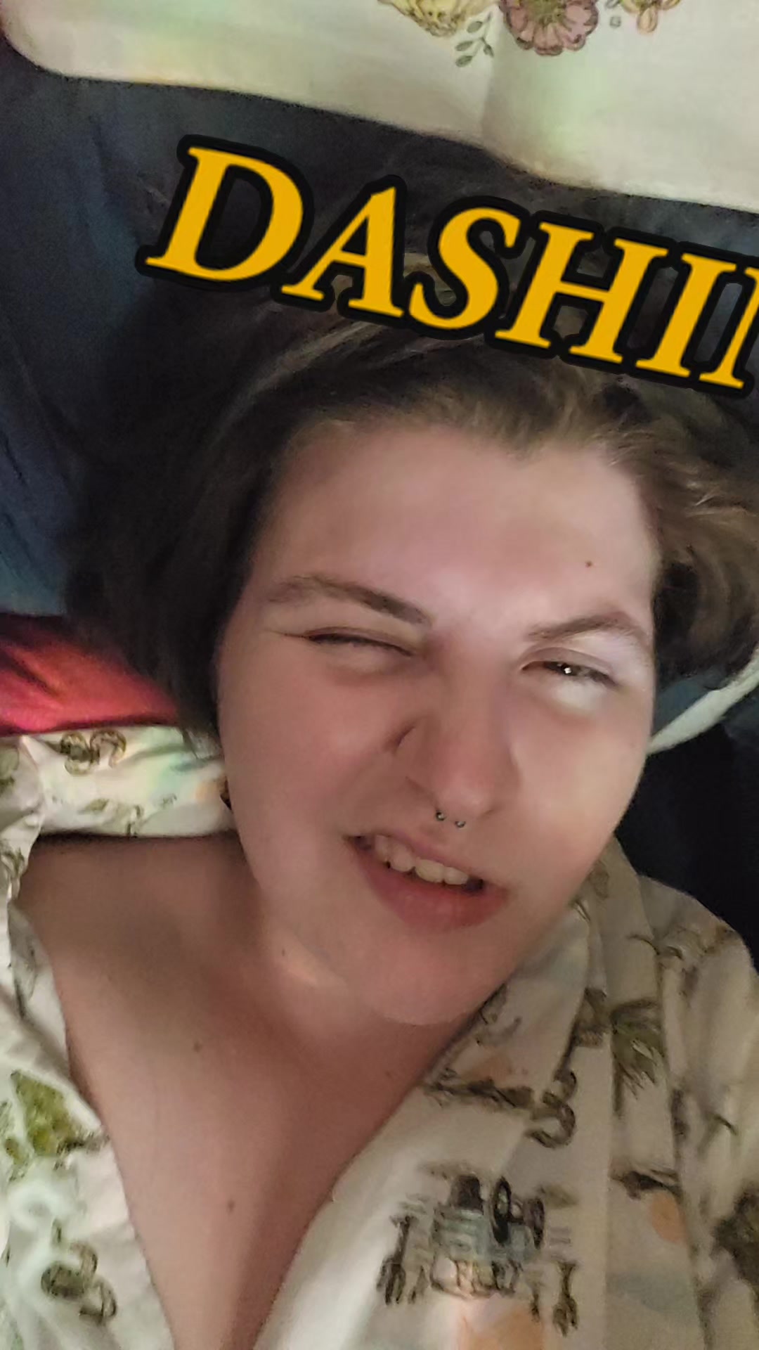 @Anna