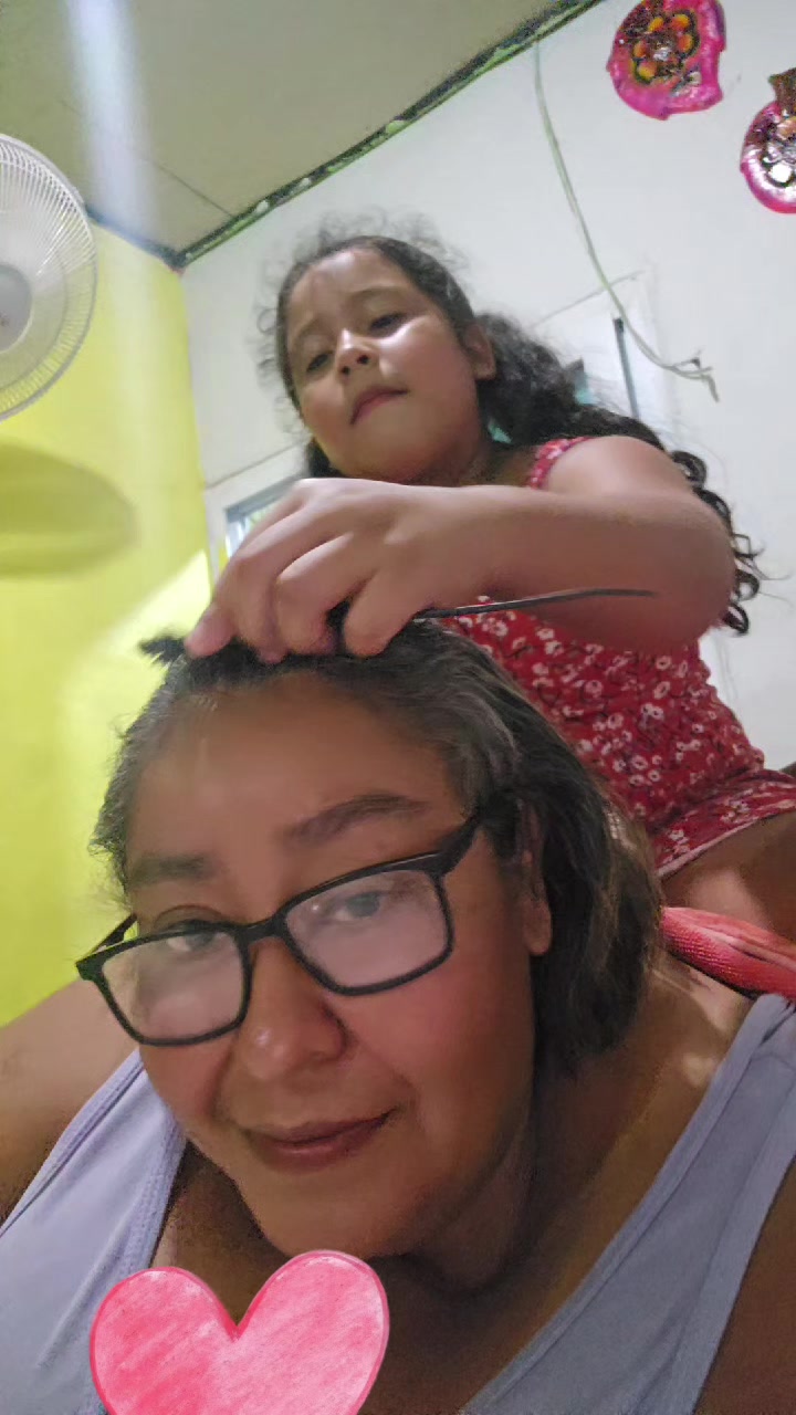 @Delmis molina