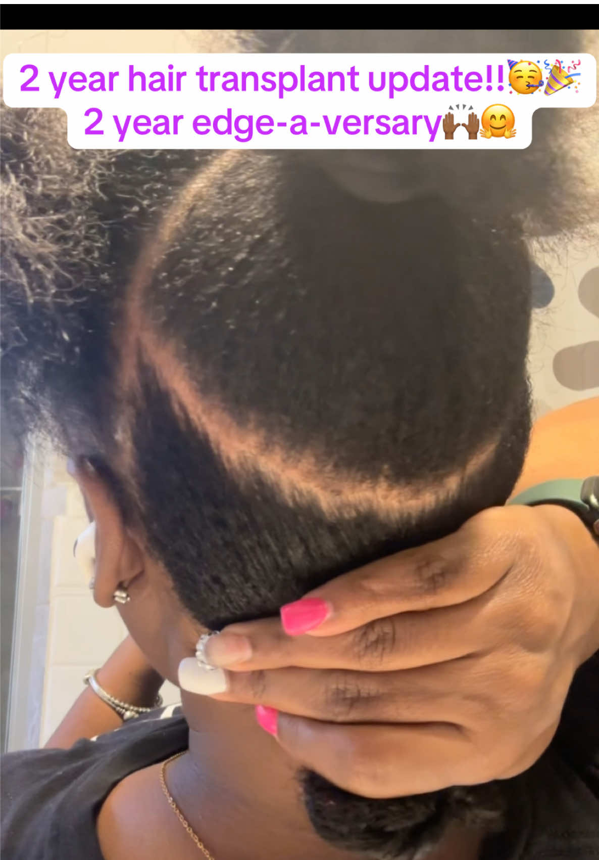 @HairVoyage