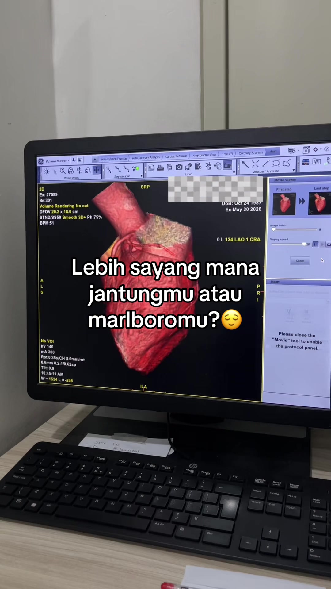 @Sobat Radiology
