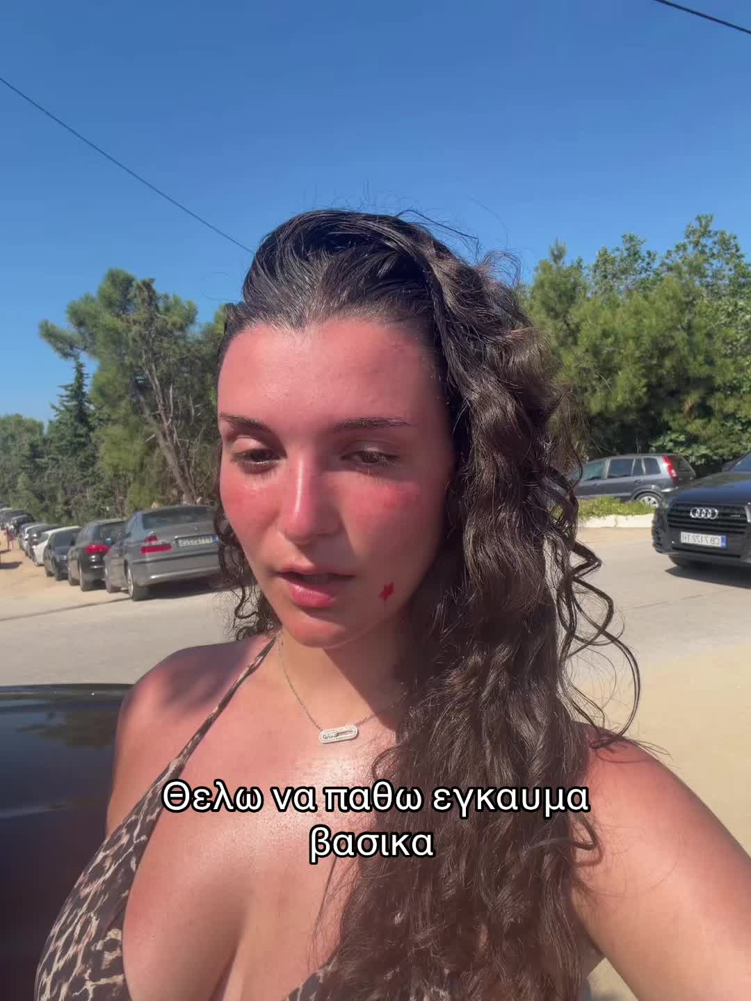 @Zoe