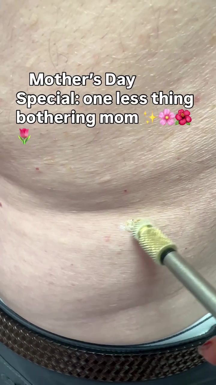 @Dr. Leela A | Dermatologist