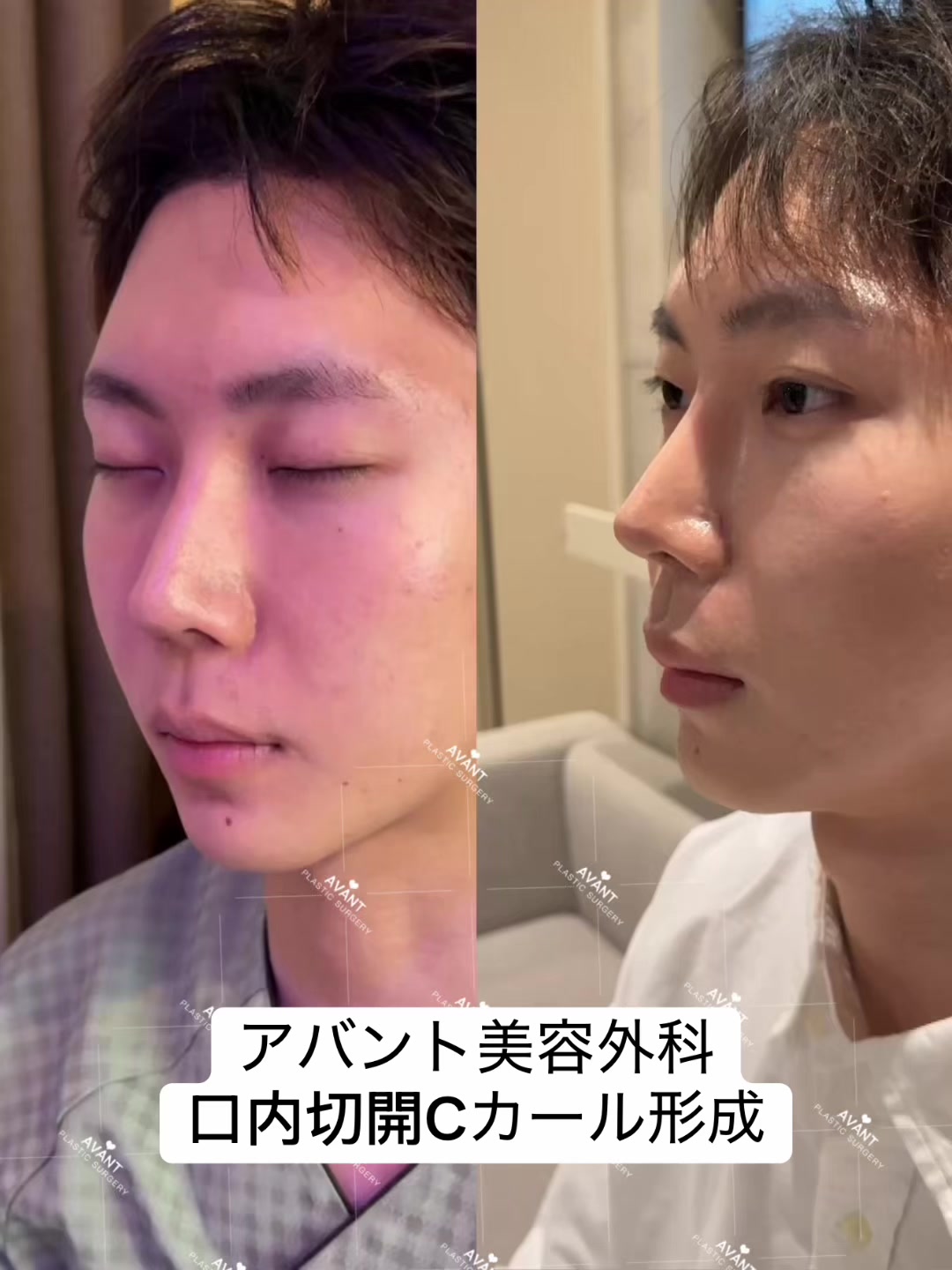 @Avant美容外科
