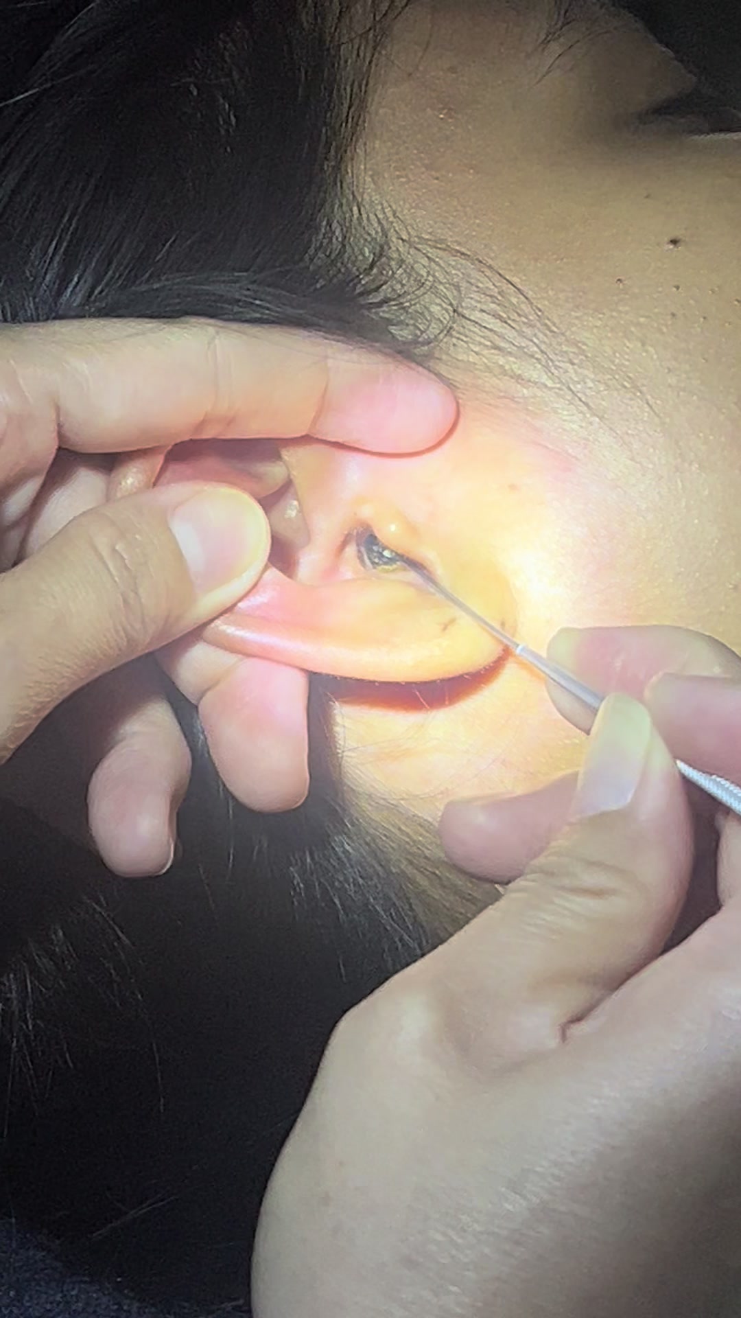 @ហាង សំអាតត្រចៀក 081 674455