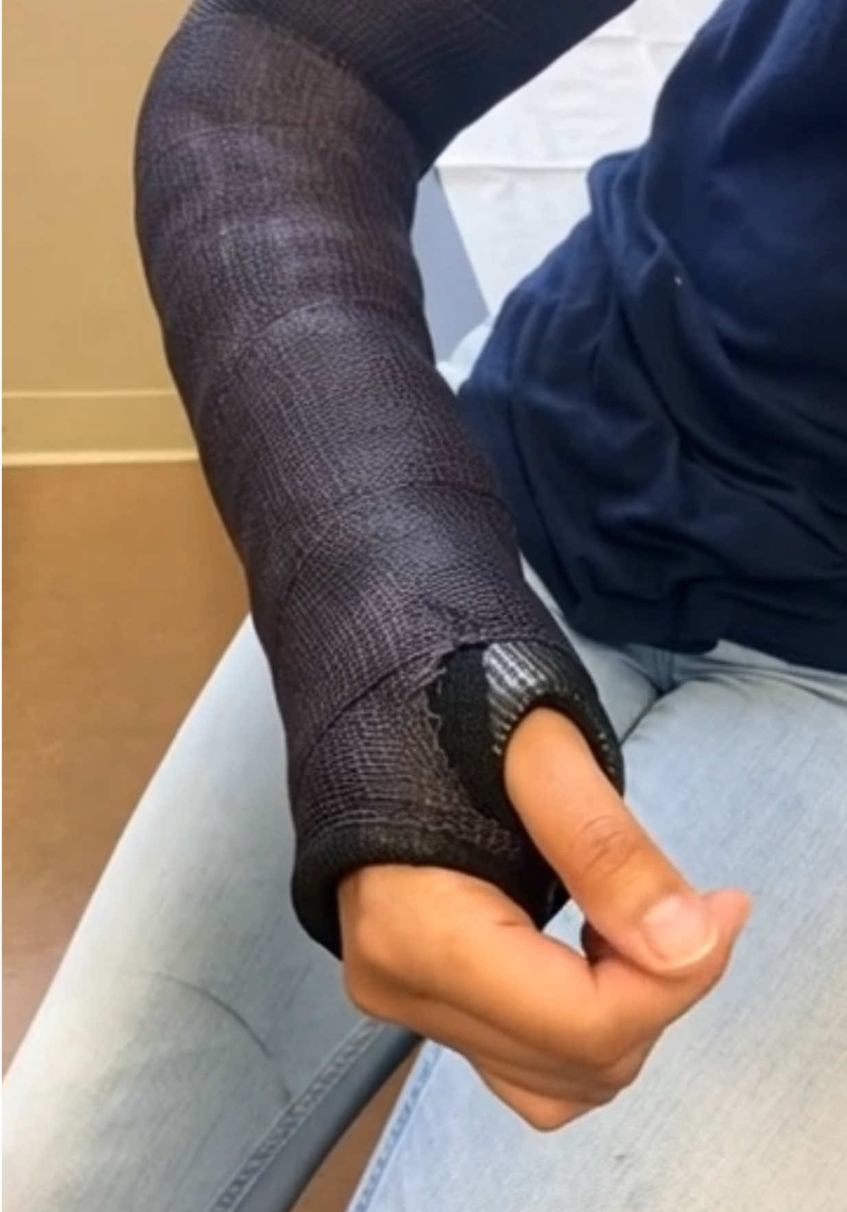 @Gips Fetish