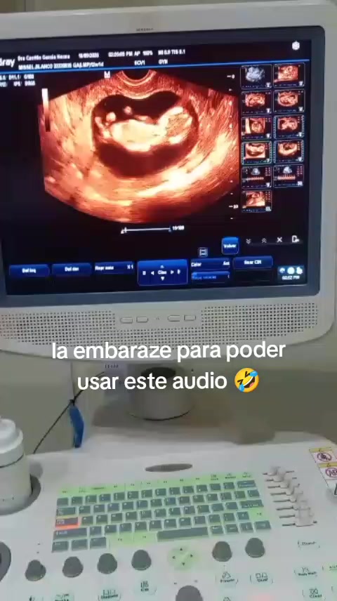 @wilfran ✔️