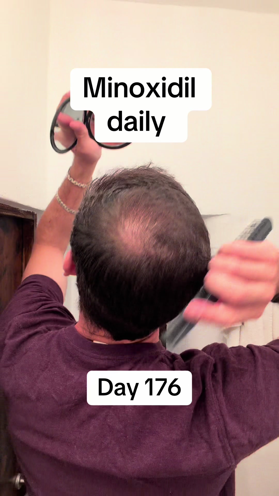 @scalp.hero