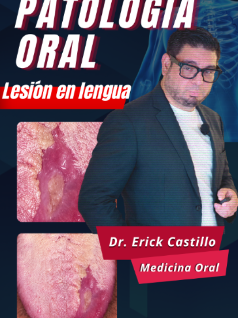 @Dr. Erick Castillo