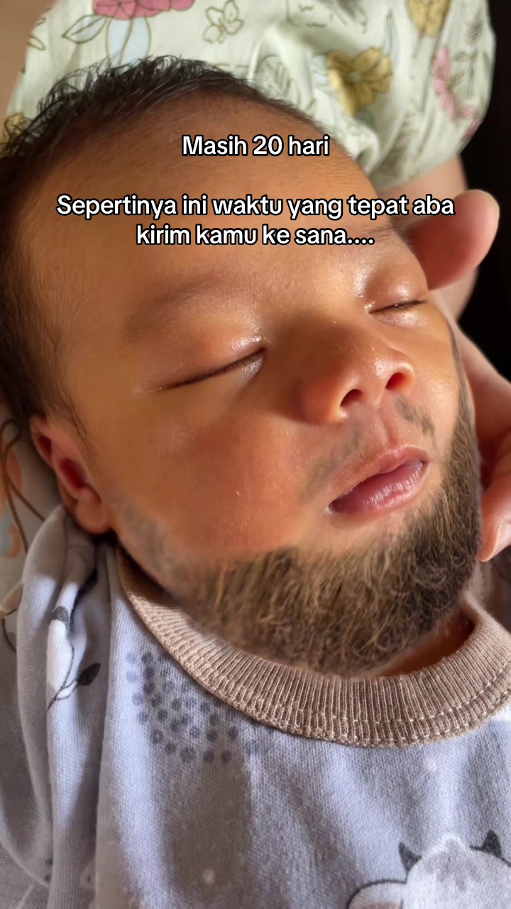@Dimas Pabelo