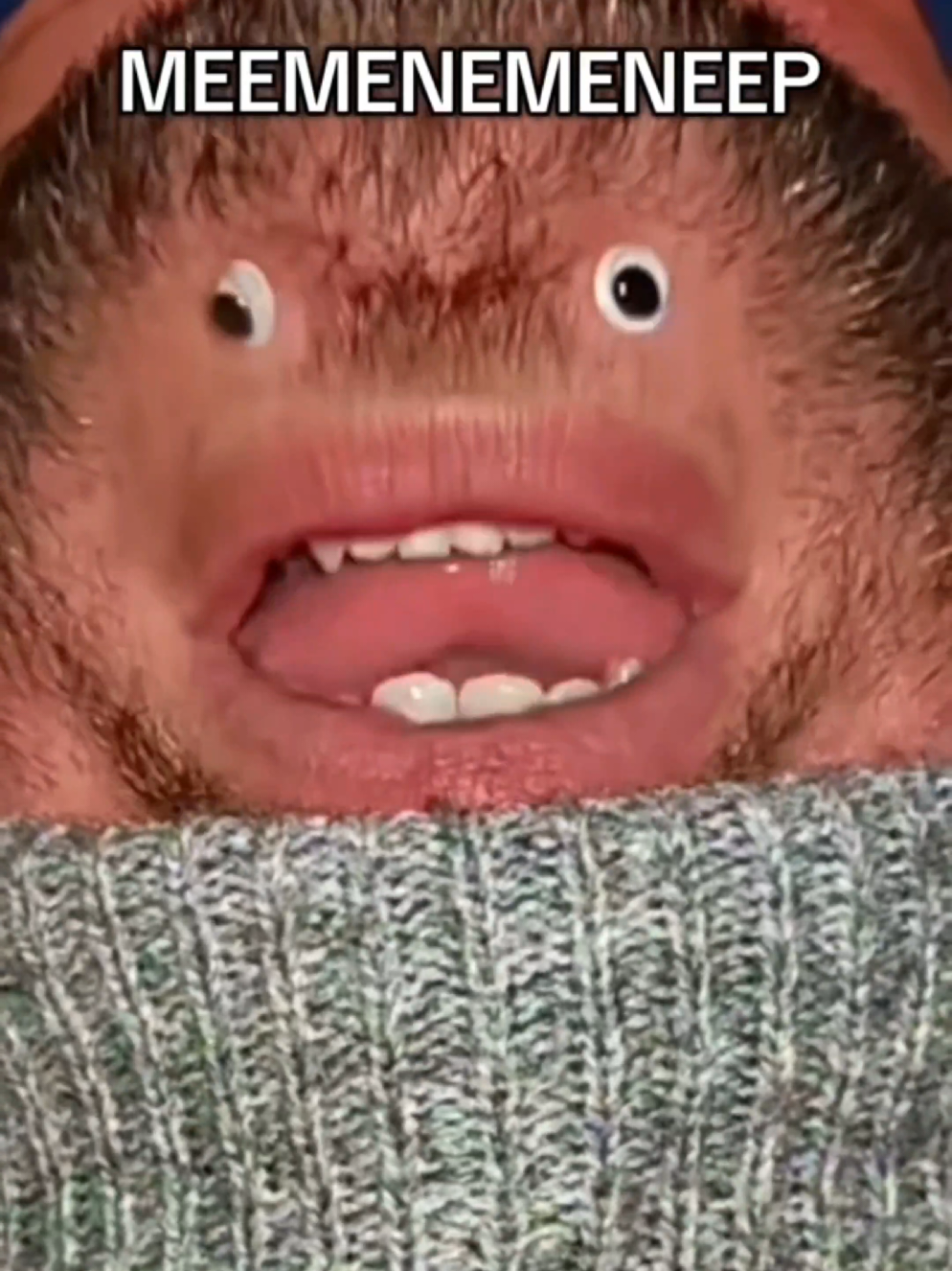 @Chinfaced