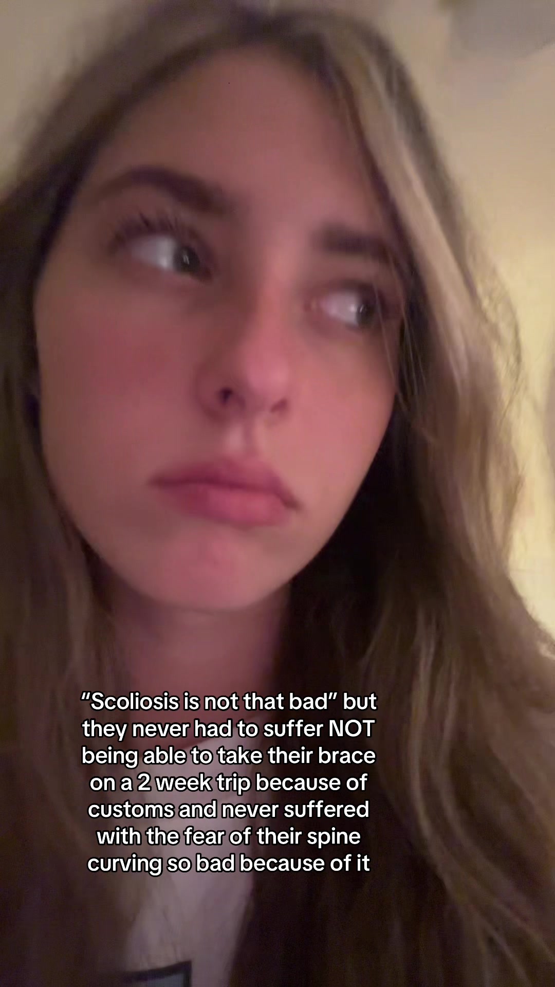 @Em bracethescoliosis