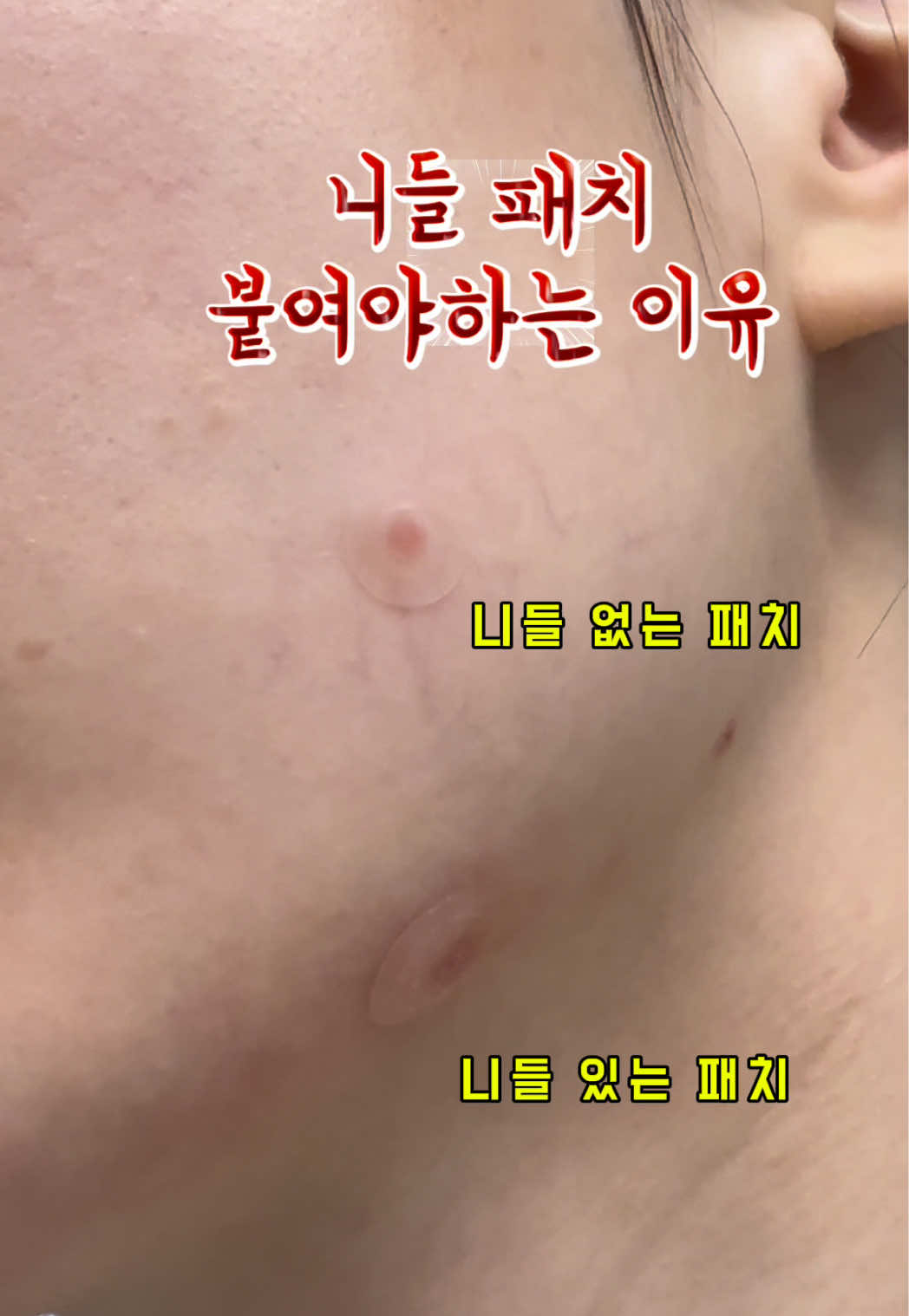 @한조니 Shelly