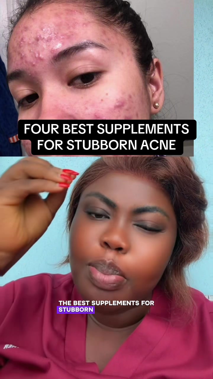 @CelebrityNurseEsther2