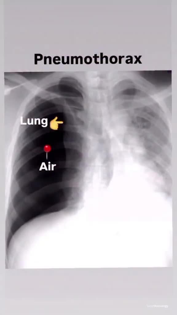 @the radiology zone