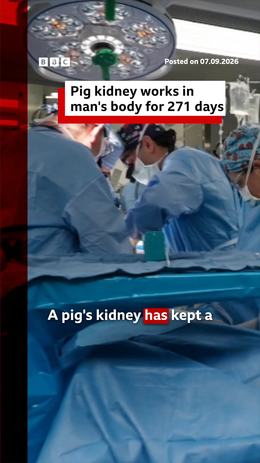 @BBC News