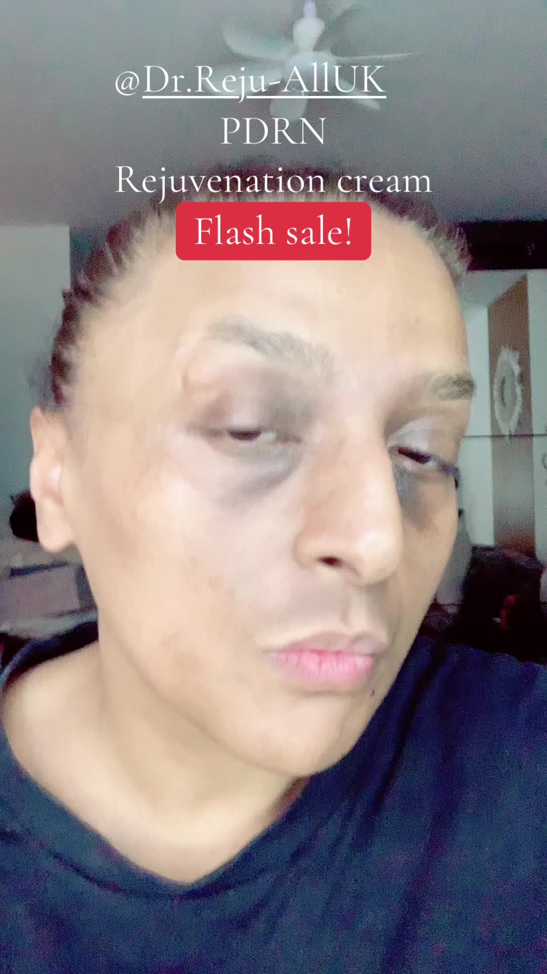 @Billeegene