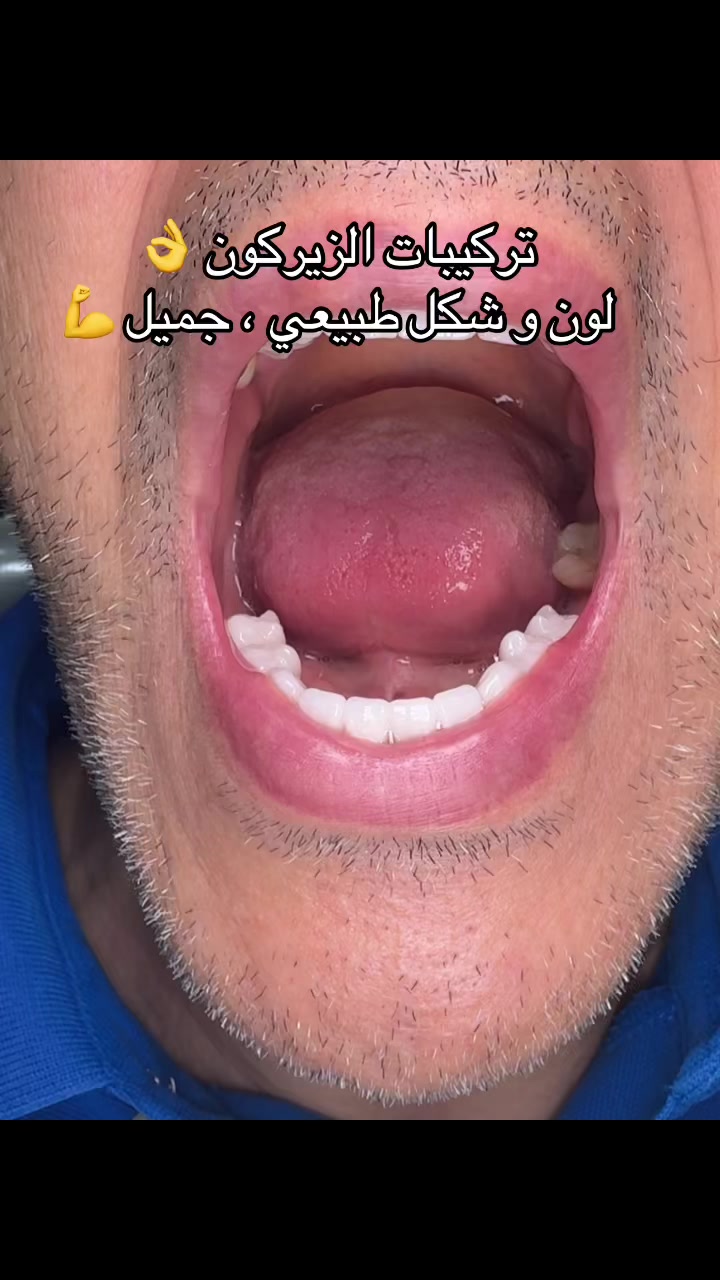 @GOSMILE ROUIBA🇩🇿