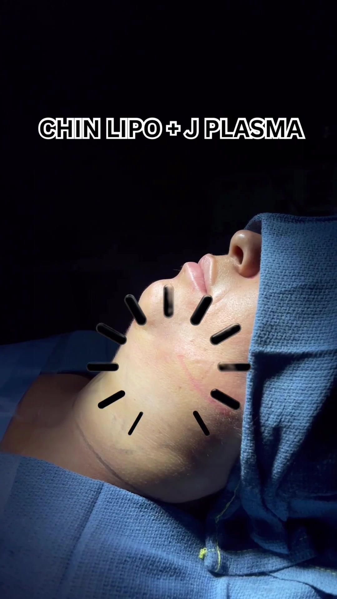 @BioAesthetic305