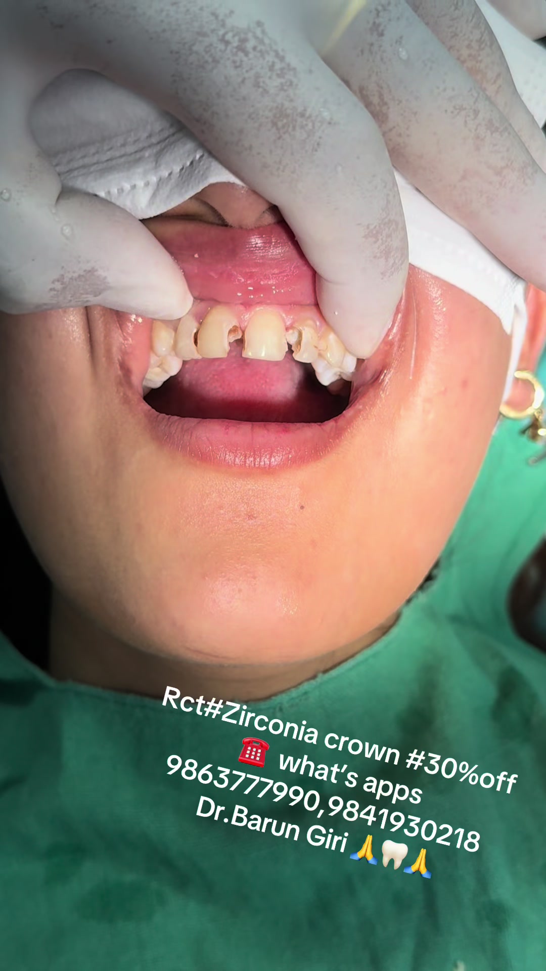 @Unique dental clinic Chabahil
