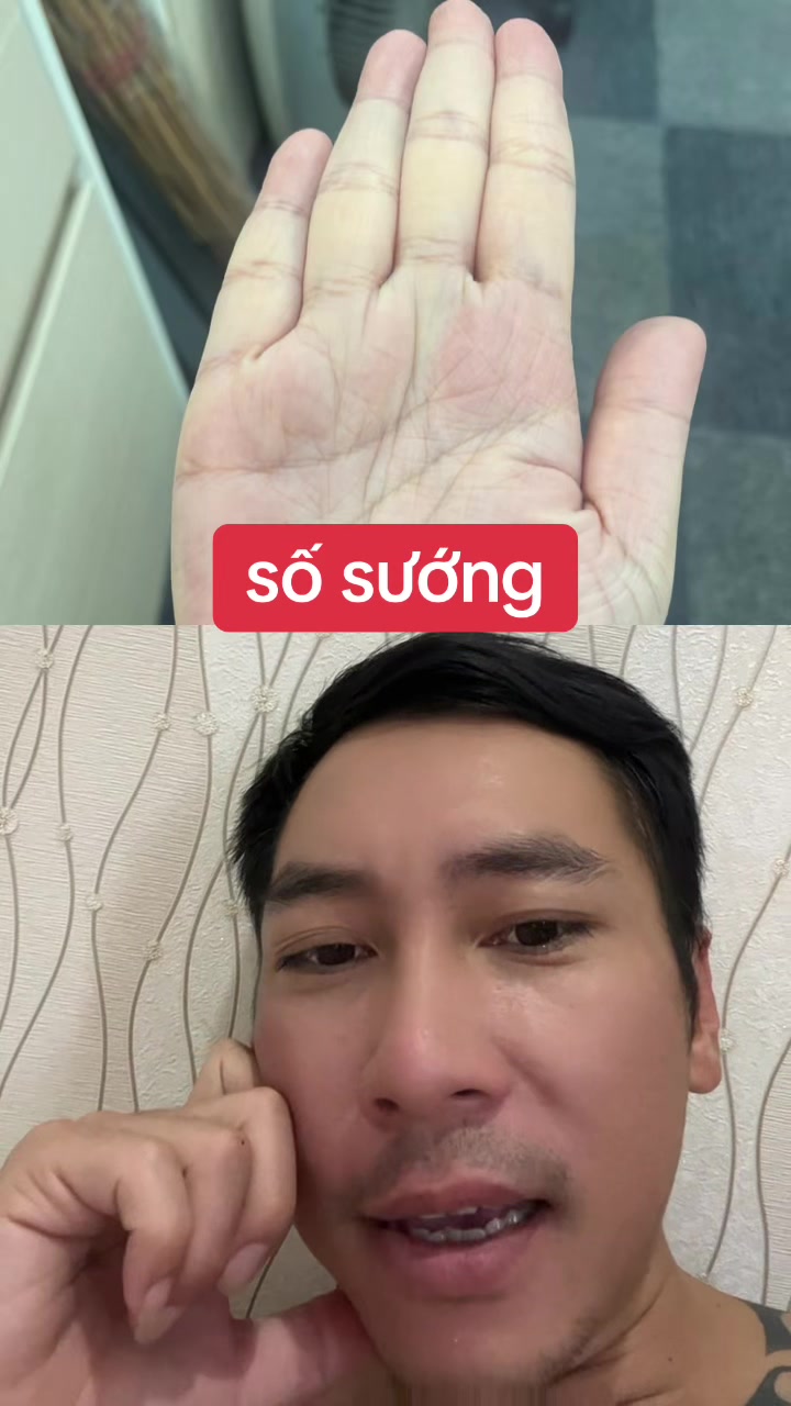 @Tuệ Nh&atilde;n ✅