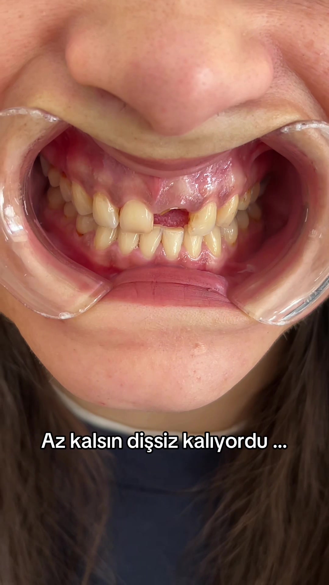 @Diş Hekimi Handenur Duru