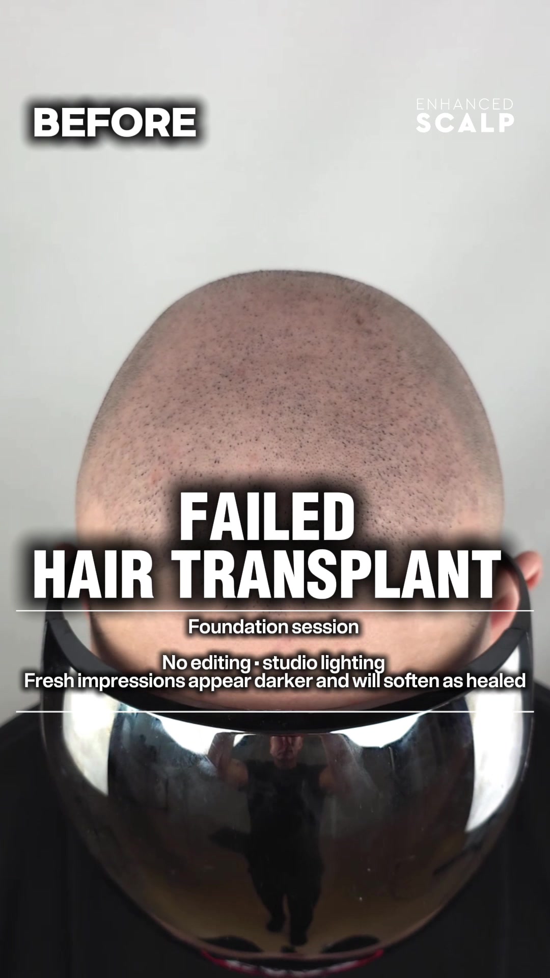 @Enhanced Scalp
