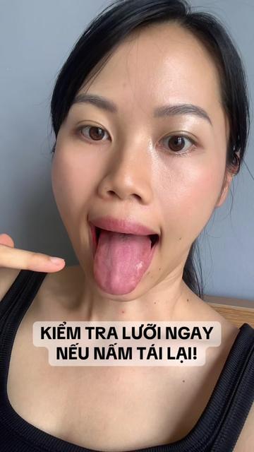@huyendao_thaidoc