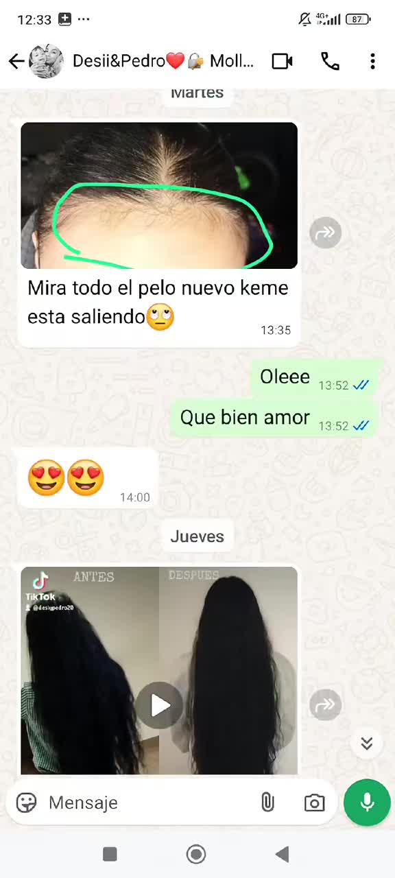 @Ester Salazar