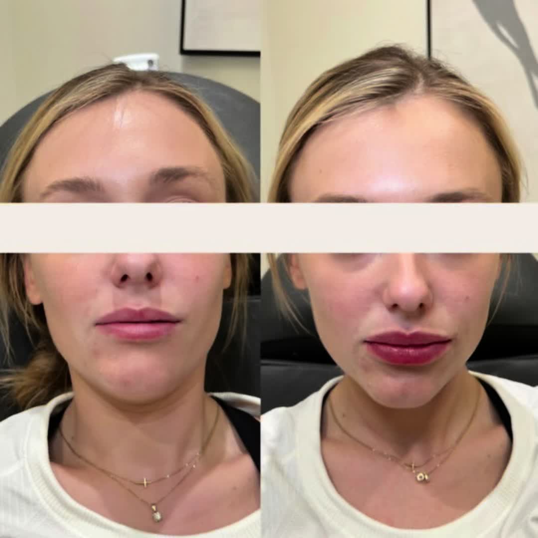 @tox.nurse.j