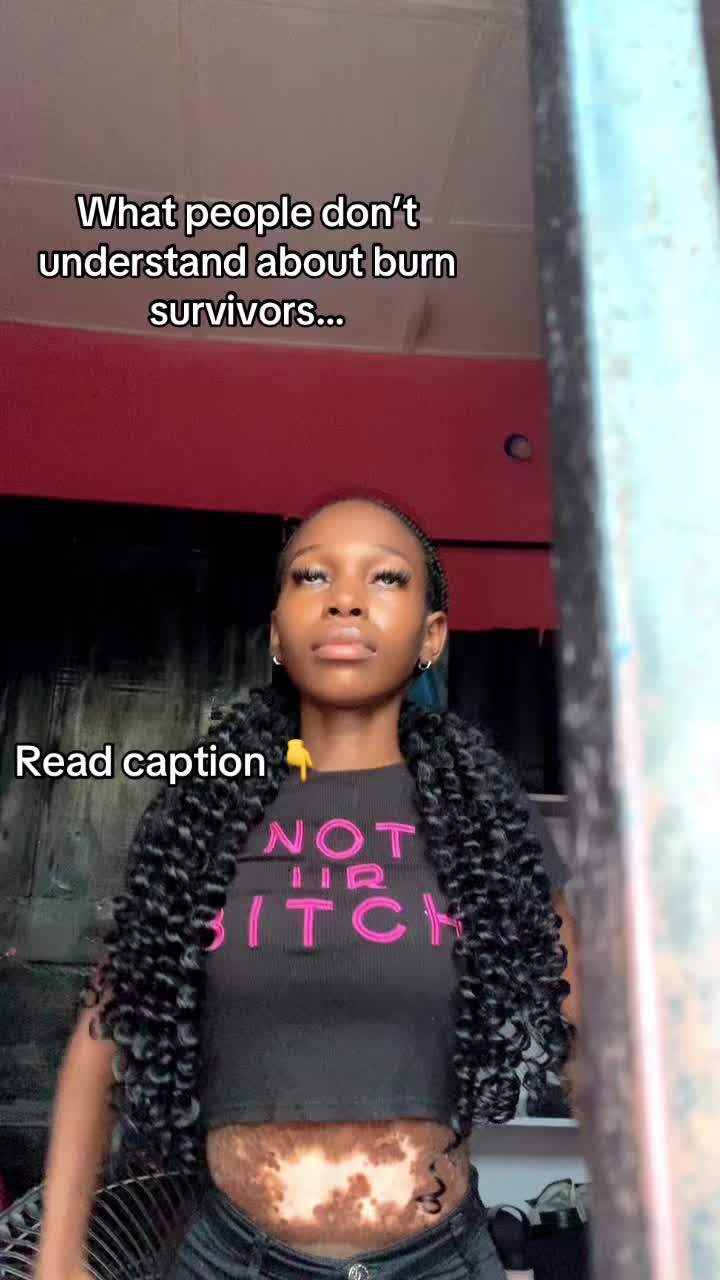 @Fire survivor ❤️