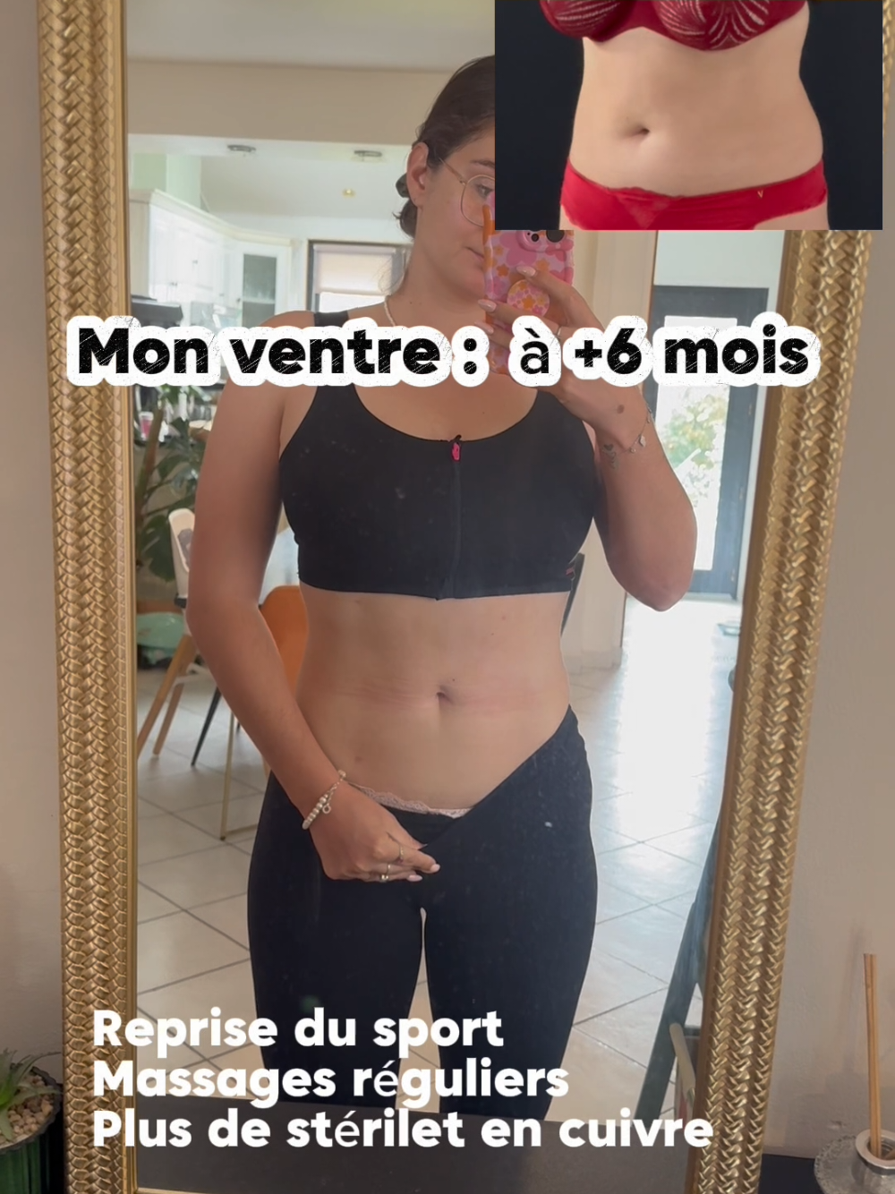 @Vivi-lipoedema