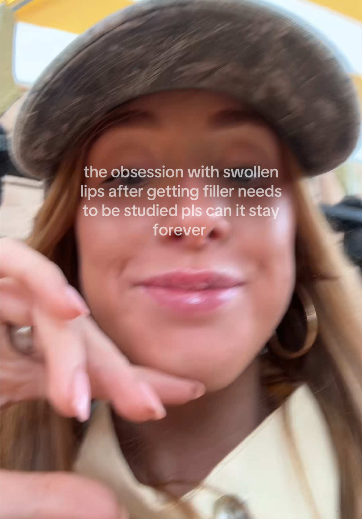 @Billie