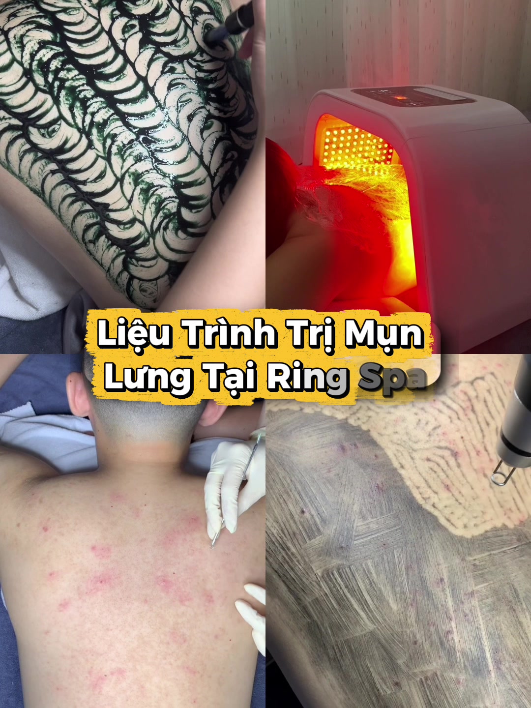 @Ring_Spa