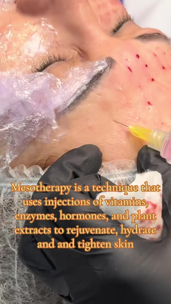 @The Facebysk