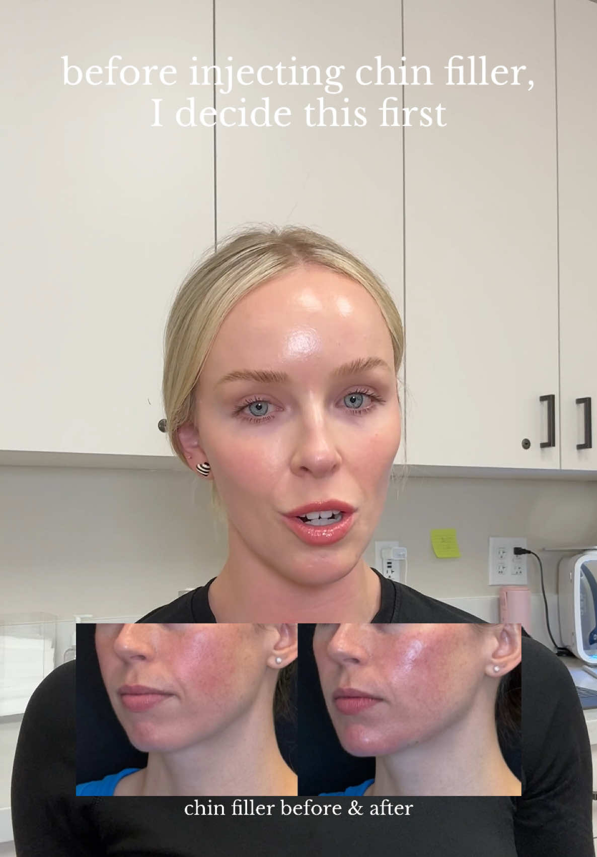 @Lindsay|Arizona Nurse Injector