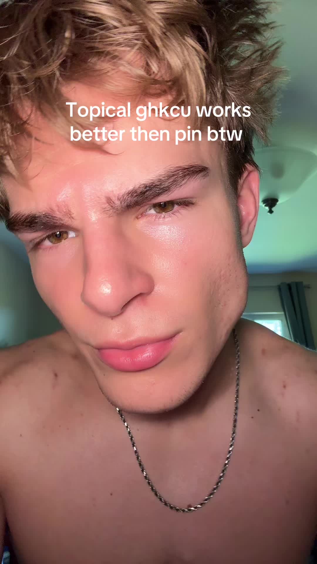 @Finn