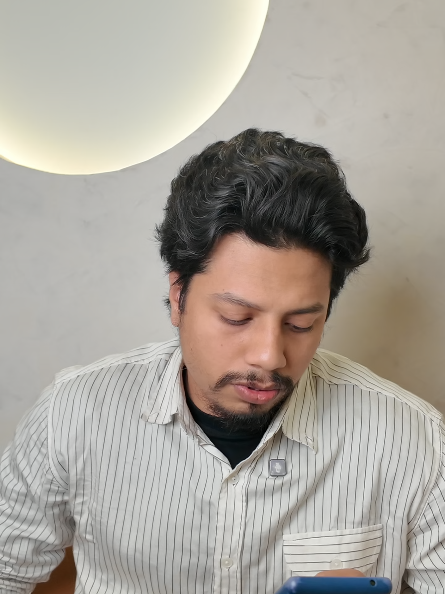 @NAZID HAIR TRANSPLANT