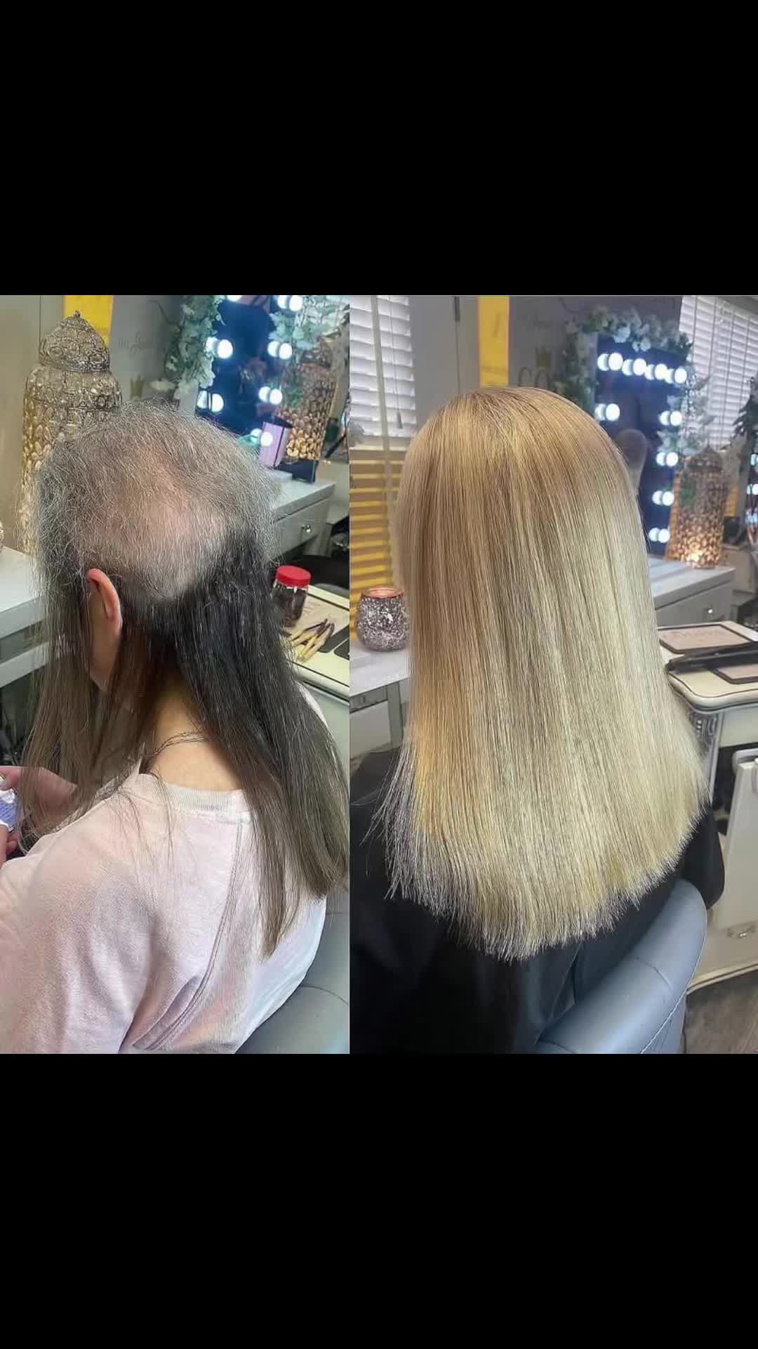 @Godiva Hair Loss Specialists
