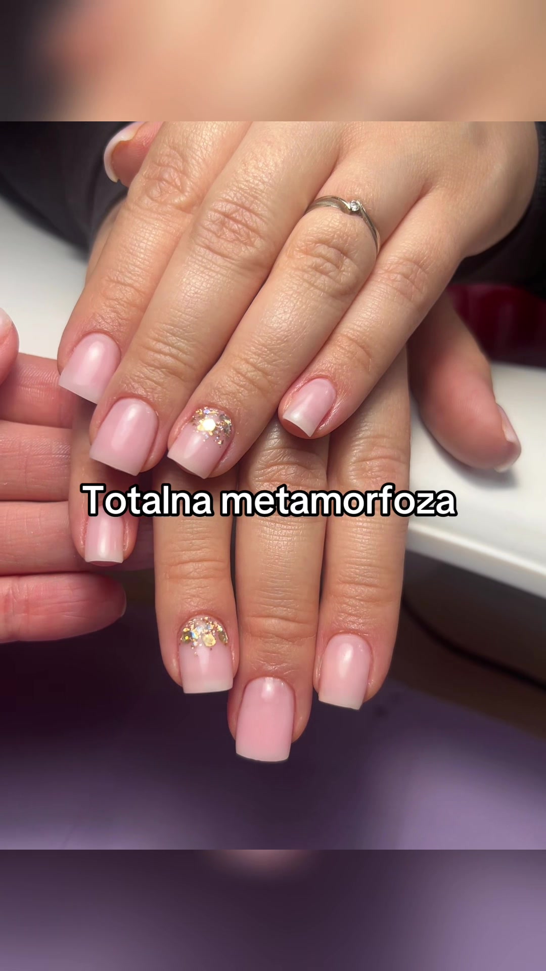 @Aneta
