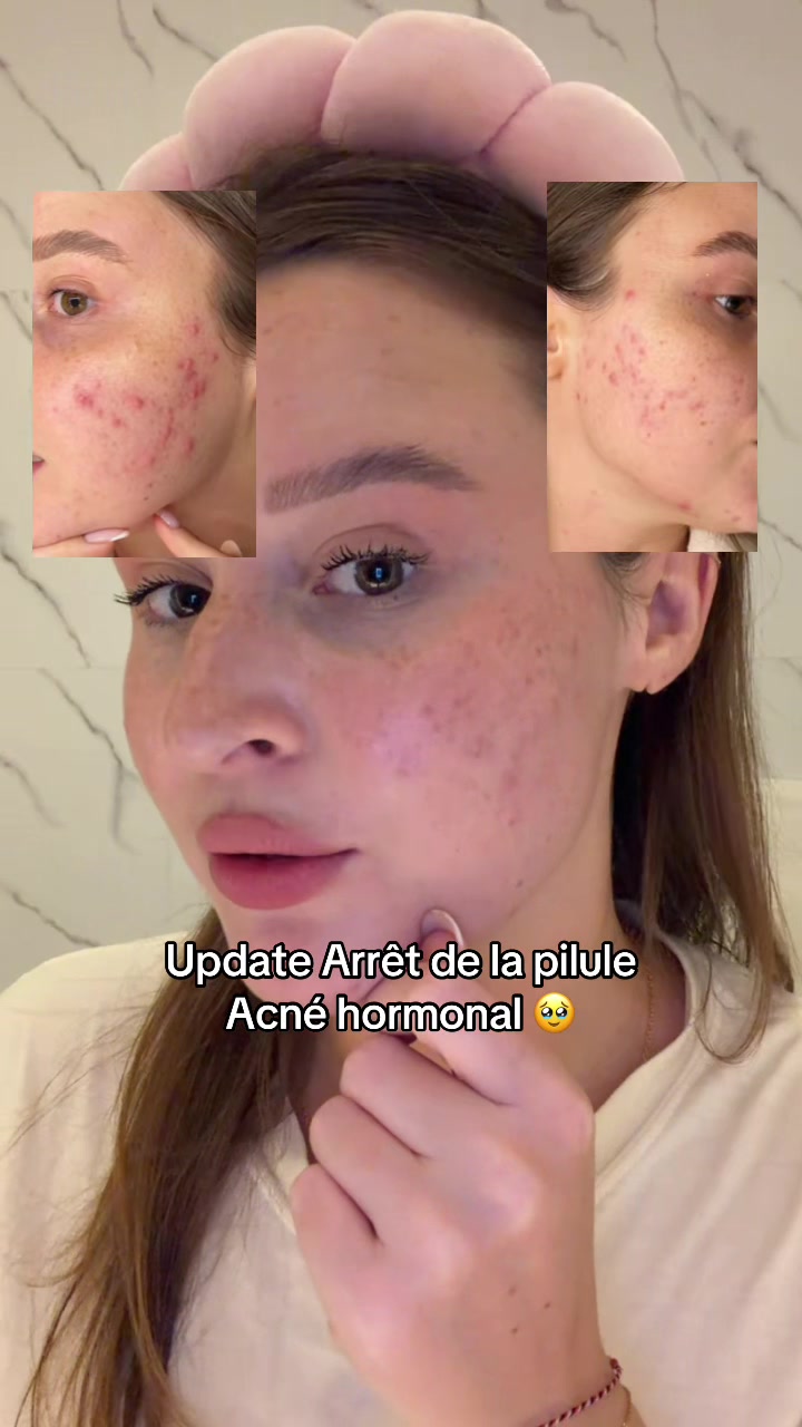@Philippine 🤳💋